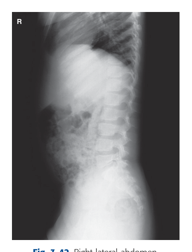 Projection X-Ray