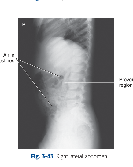 X-Ray Anatomy