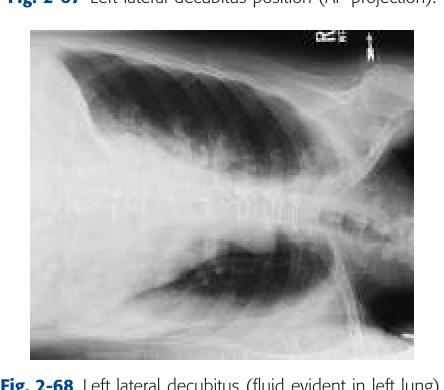 Fig. 2-68