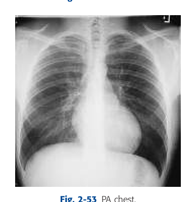 Fig. 2-53