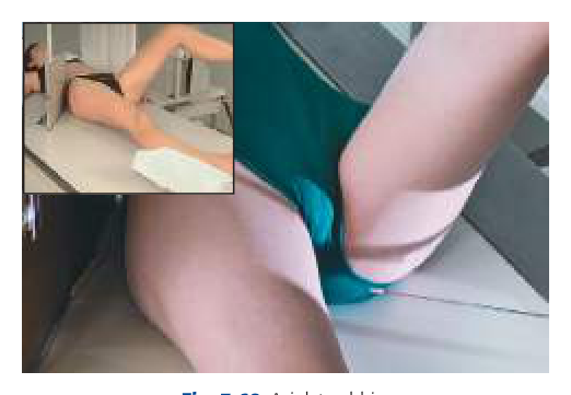 Positioning