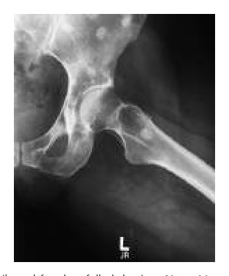 Projection X-Ray