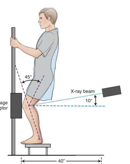 Projection X-Ray