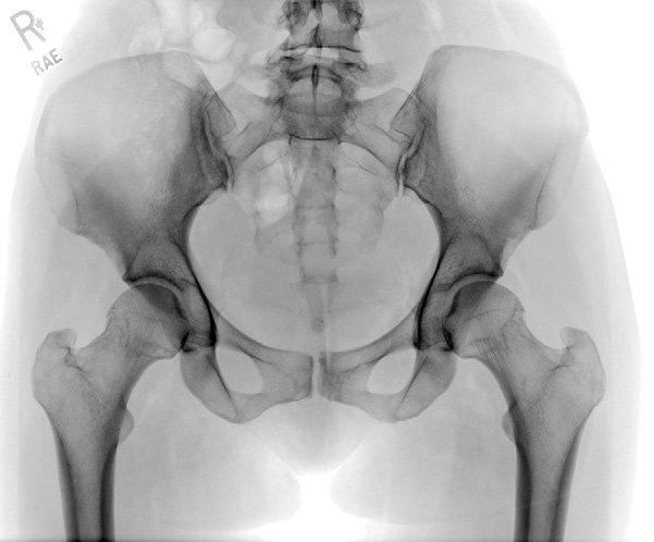 Fig. 7-17 Pelvis—AP. D F B A