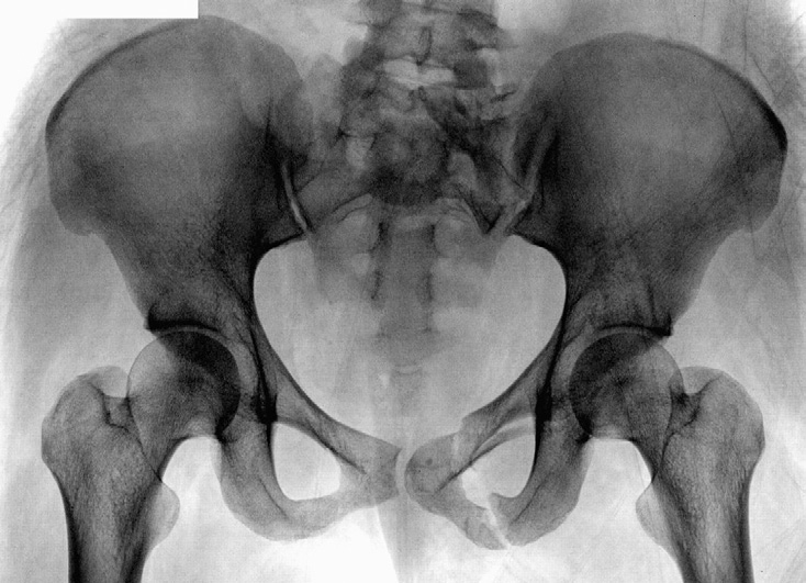 Fig. C7-78 AP pelvis (male or female?).