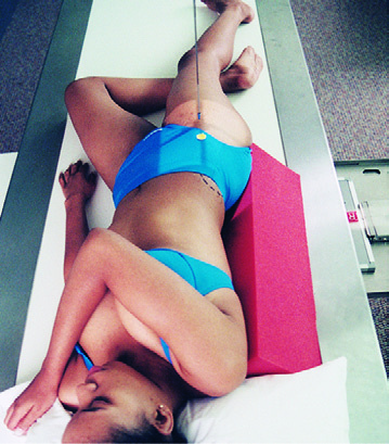 Fig. 7-57 right LPO—centered for right (upside) acetabulum. R