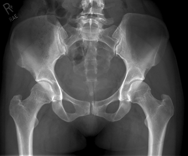 Fig. 7-15 Female pelvis.
