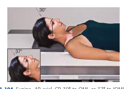 Positioning