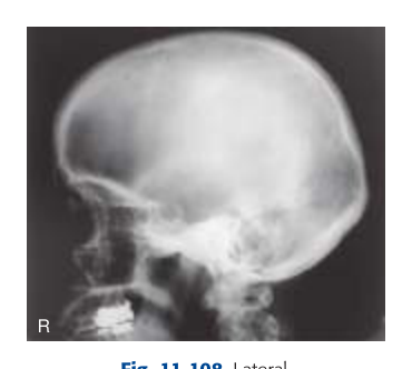 Projection X-Ray