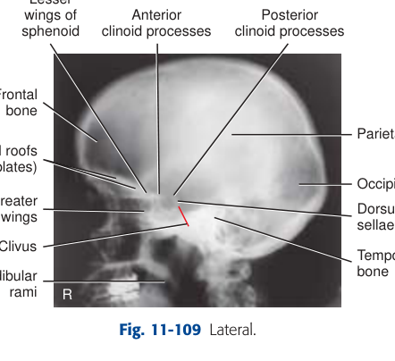 X-Ray Anatomy