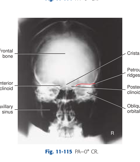 X-Ray Anatomy