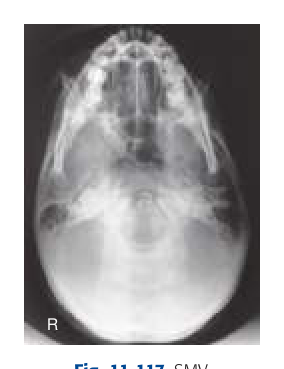 Projection X-Ray