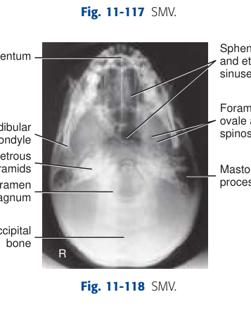 X-Ray Anatomy