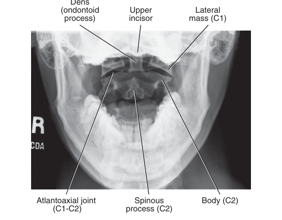 X-Ray Anatomy