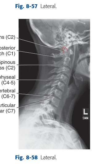 X-Ray Anatomy