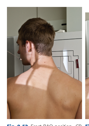 Positioning