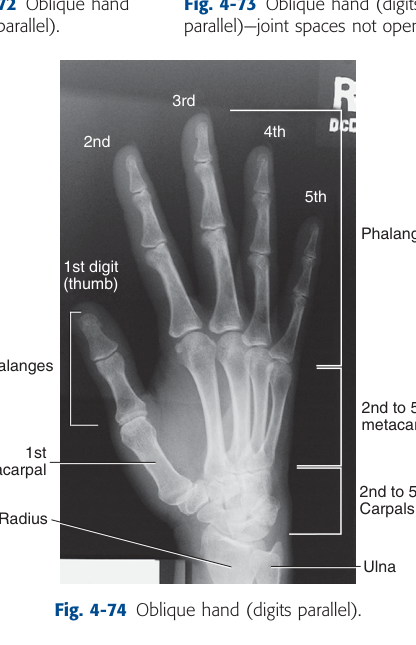 X-Ray Anatomy