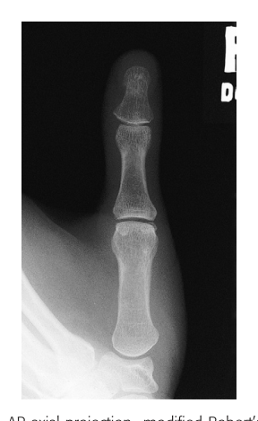 Projection X-Ray